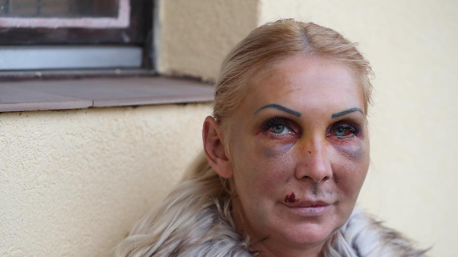 Milliókra perli Orosz Bernadettet volt barátja, aki állítólag majdnem halálra verte őt