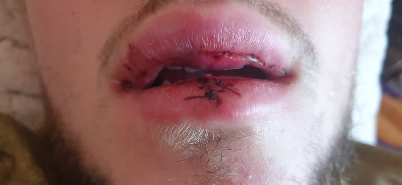 Elkeseredett emberek kérnek segítséget- A MÖM harcba hív!