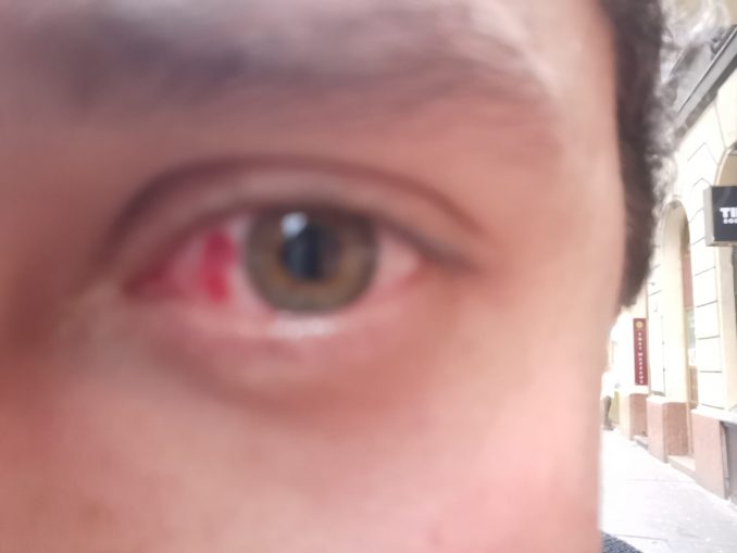 Szent Korona Rádió: Újabb külföldi antifa támadás történhetett Budapesten egy Lonsdale pulóver miatt