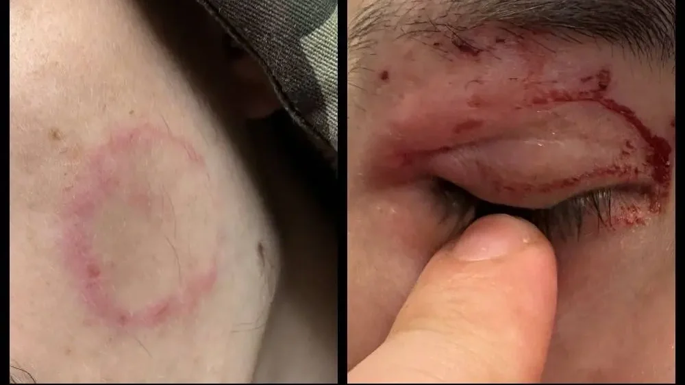 Társait terrorizálja, veri véresre egy gyerek a Hűvösvölgyi Gyermekotthonban – tehetetlenek a nevelők