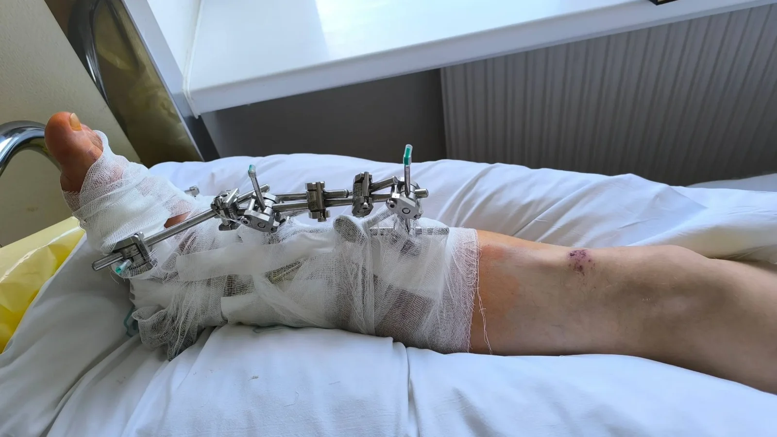 Amíg nincs közbiztonság, senki nem élhet gondtalanul, boldogan – eszmefuttatás egy megtörtént eset kapcsán