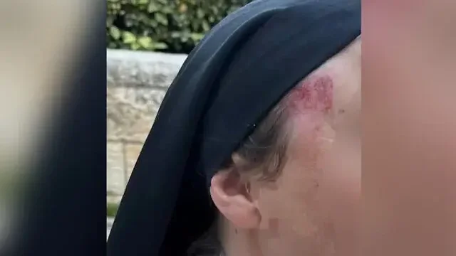 Kép forrása: Times of Israel