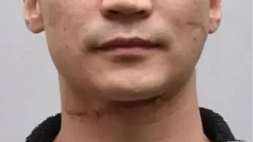 Batdorzs Bajarszambú sérülései | Kép forrása: police.hu